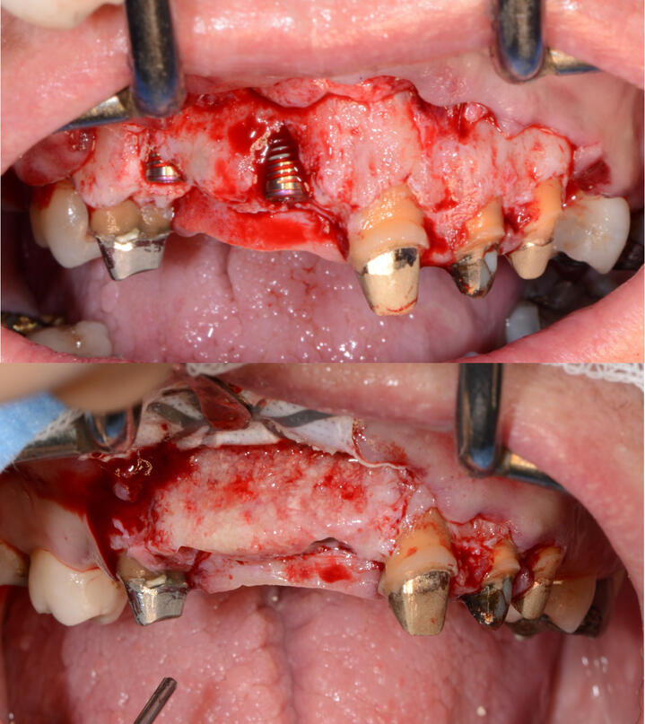 Comment valoriser la maintenance?