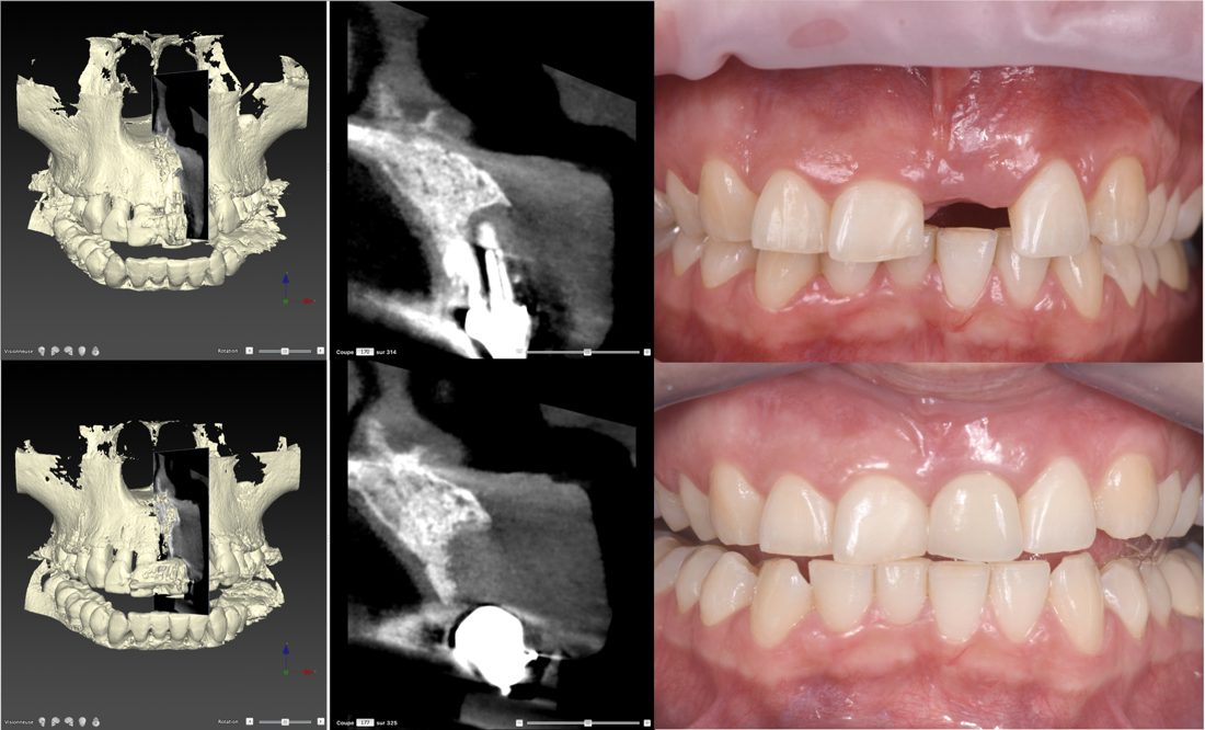 Contrôles cliniques et radiographiques