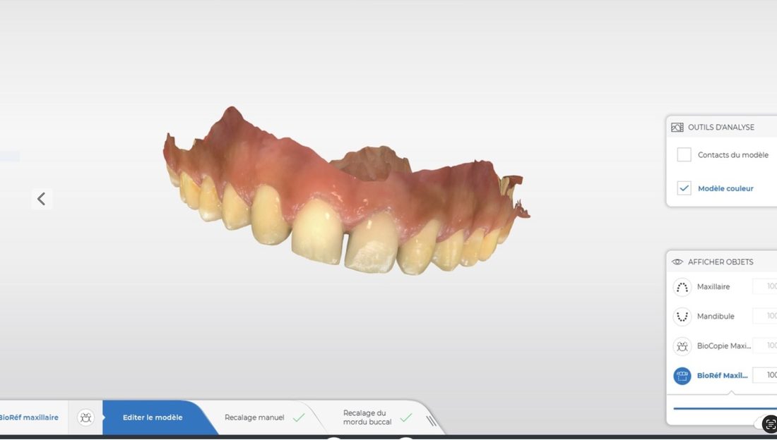 Workflow numérique : scan 3D intégré au diagnostic global